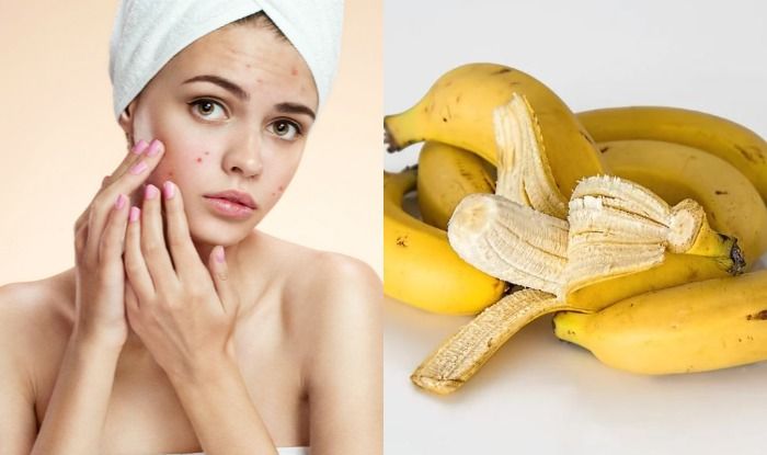 banana benefits for skin