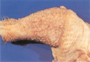 Lymphoid Leukosis in Poultry