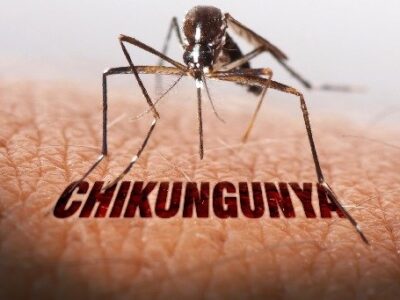 Chikungunya