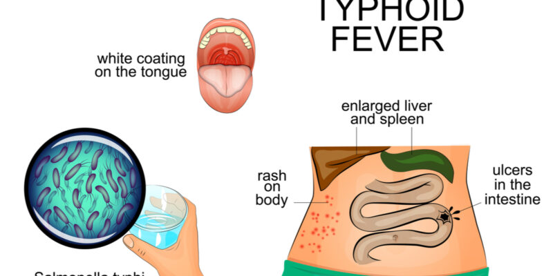 Typhoid Prevention