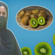 Kiwi Cultivation